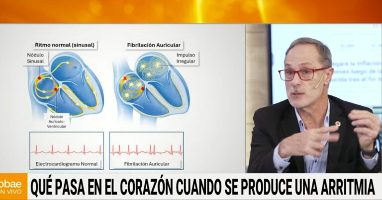 Qué es la fibrilación auricular, una amenaza silenciosa que puede provocar graves consecuencias para la salud