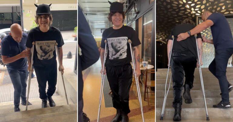 Maxi Trusso habló de su recuperación y el desafío de volver a caminar: “Es un trabajo interno”