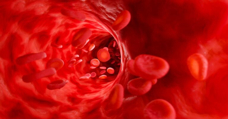 Embolia: causas, síntomas y tratamiento