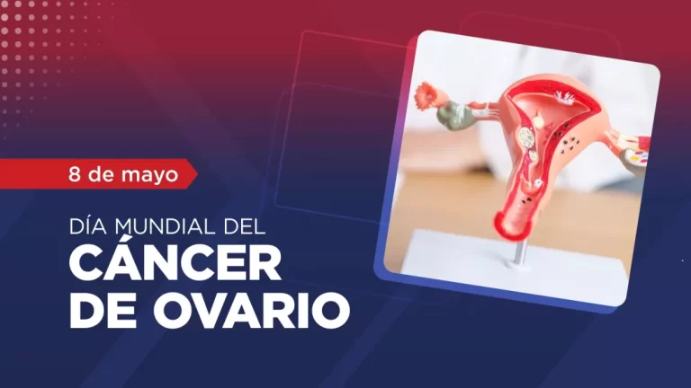 El cáncer de ovario puede permanecer asintomático hasta una etapa avanzada