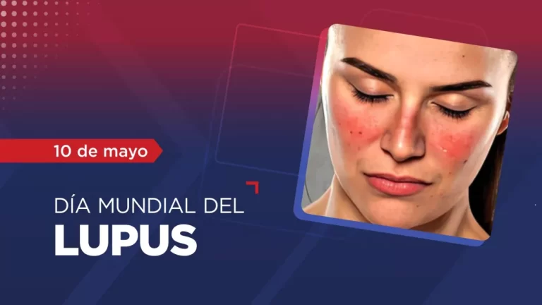 El 90 por ciento de las personas afectadas con lupus son mujeres en edad fértil