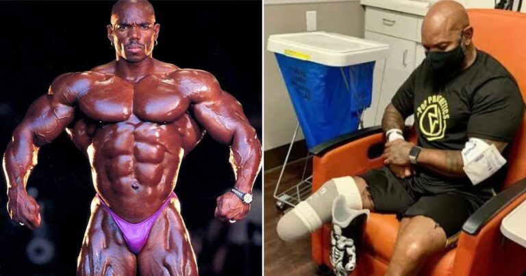 Comía 35 kilos de carne y 400 huevos por mes, llegó a la cima del fisicoculturismo, pero un problema de salud le cambió la vida