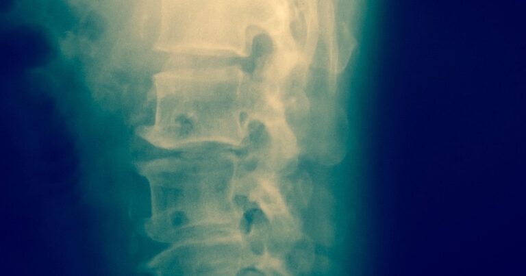 Un decodificador de ondas cerebrales descubre cómo causar movimiento en las lesiones de la médula espinal