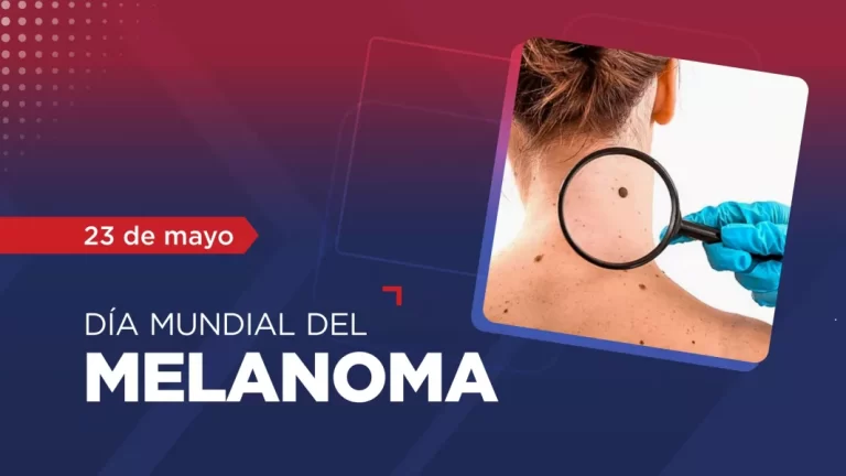 El uso de camas solares puede generar el cáncer de piel llamado melanoma