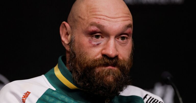La categórica respuesta de Tyson Fury sobre si saldrá del retiro: “Si apostara…”