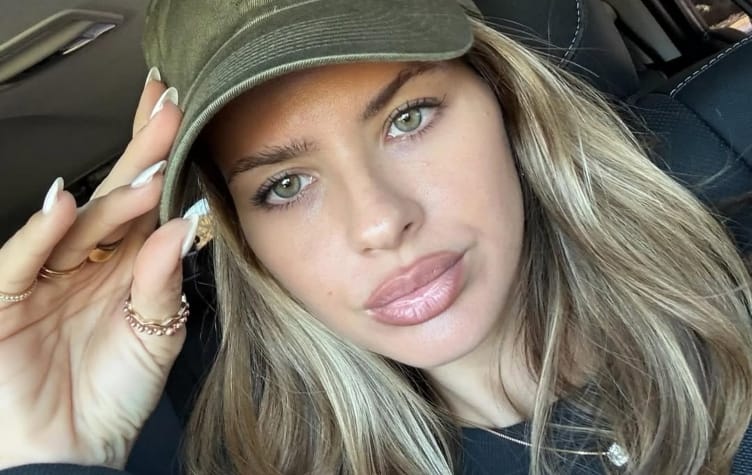 Las fotos de la China Suárez que generaron polémica: así es el antes y el después de las operaciones