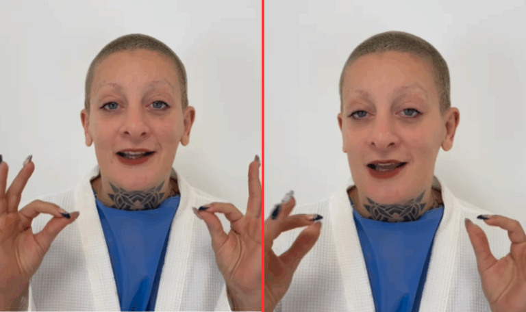 Furia Scaglione se operó la cara y mostró los sorpresivos resultados